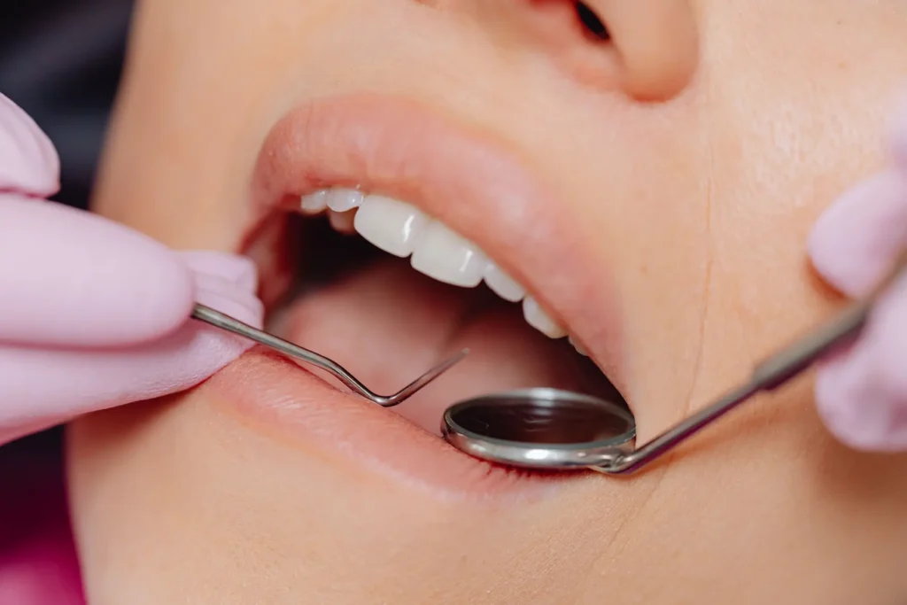 image of a woman getting dental work