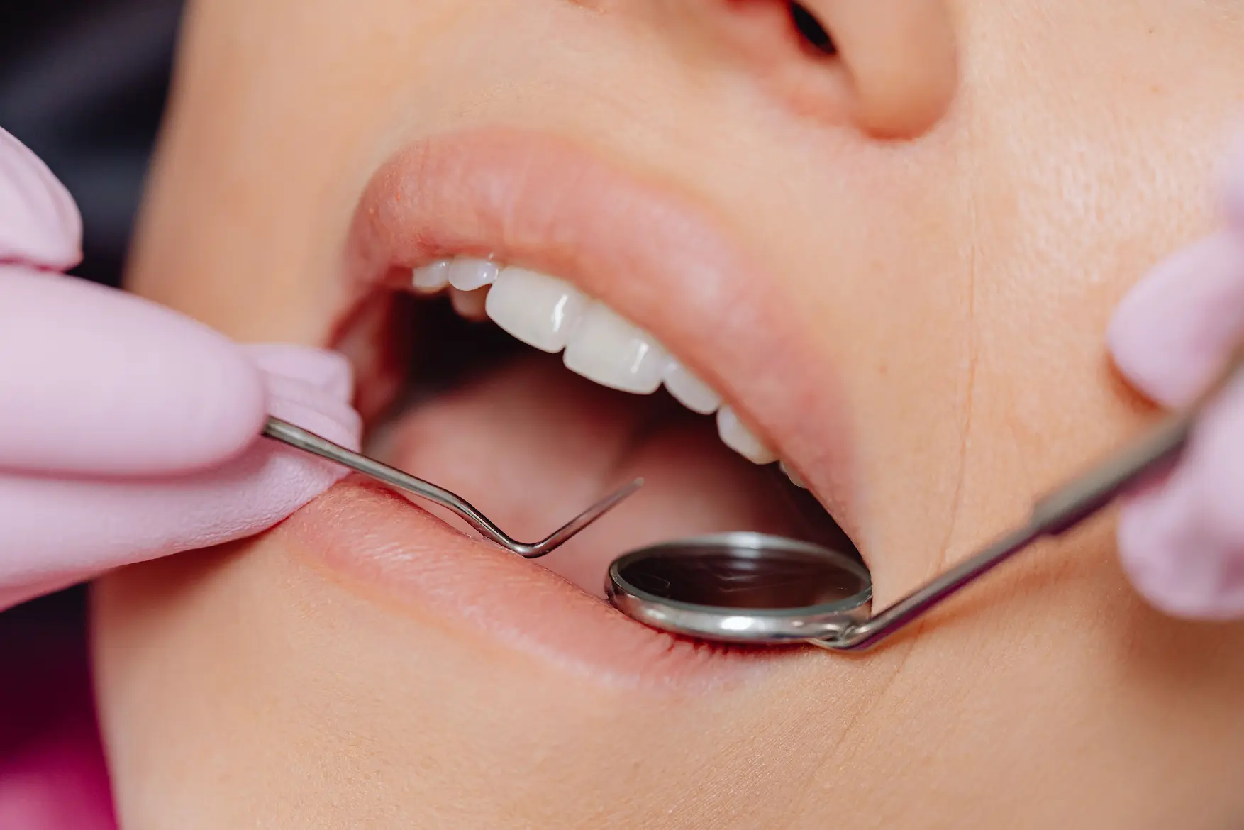 image of a woman getting dental work