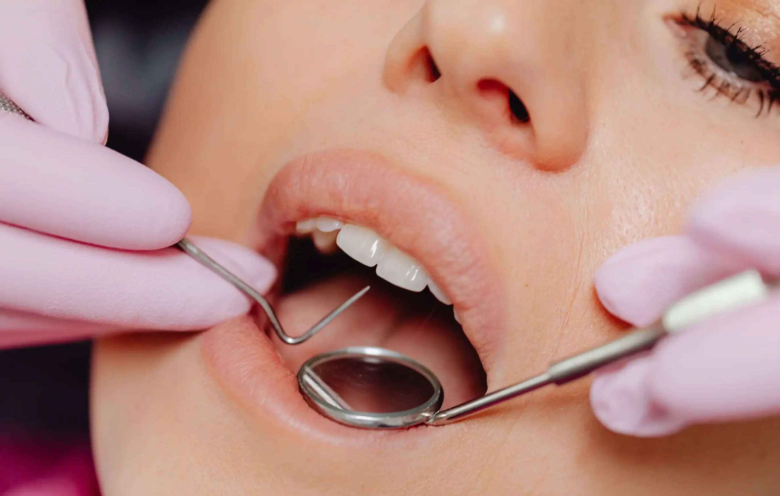 a close up image of a woman getting dental checkup